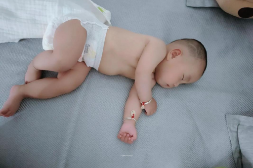 高密六个月宝宝眼睛散光